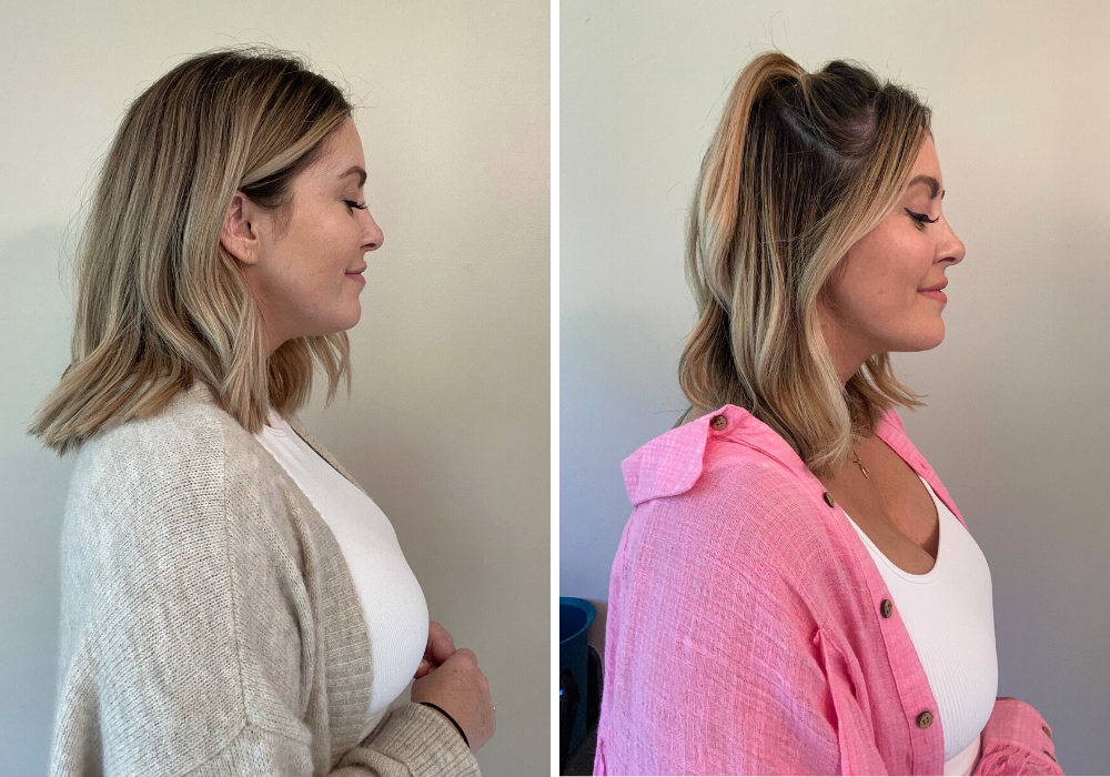 Evoke treatment